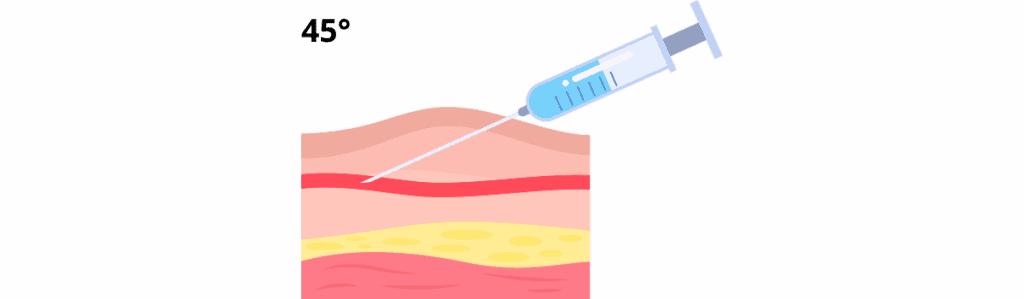 Injections sous-cutanée et Intramusculaire injection sous cutanée
